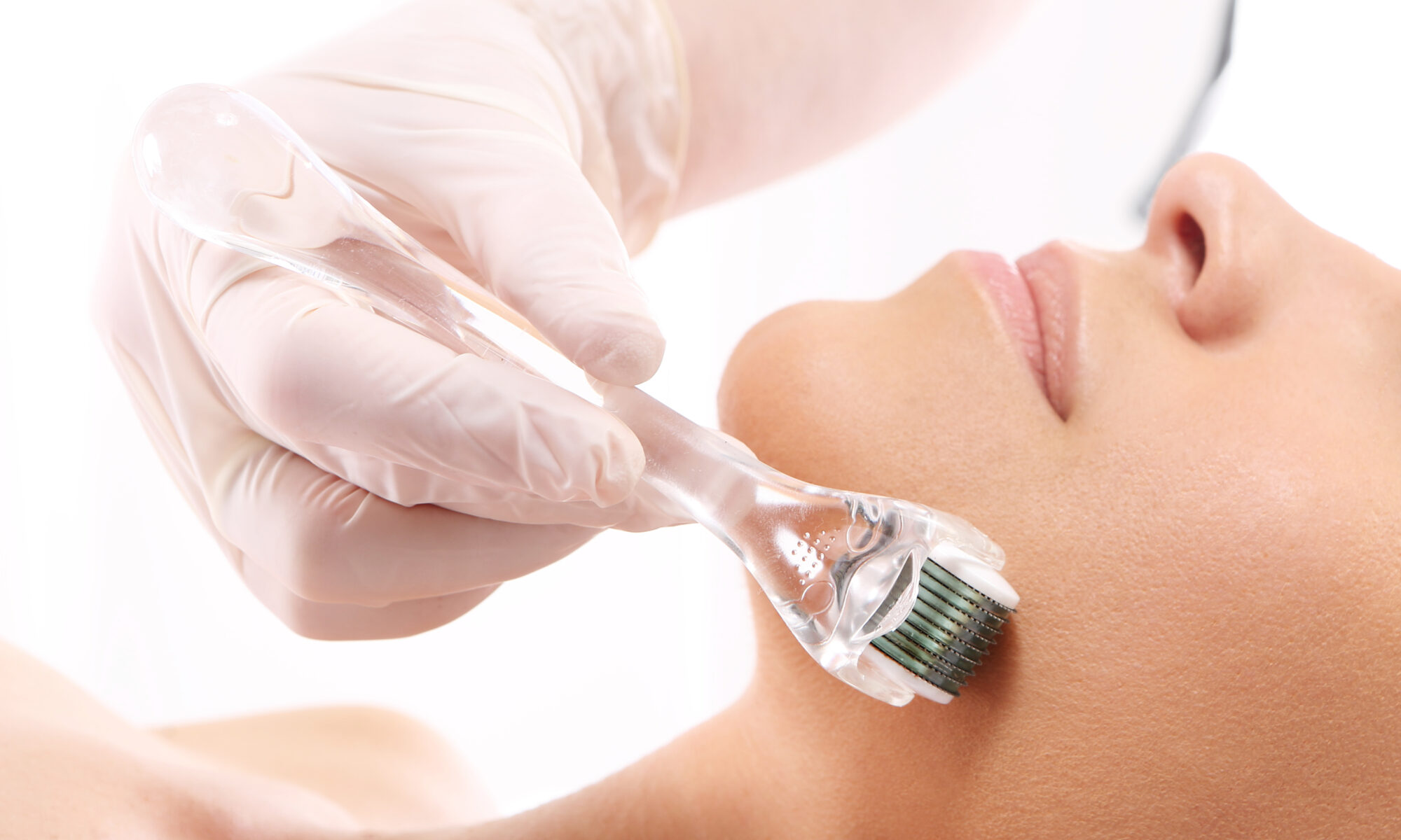 Dermaroller (Microneedling)