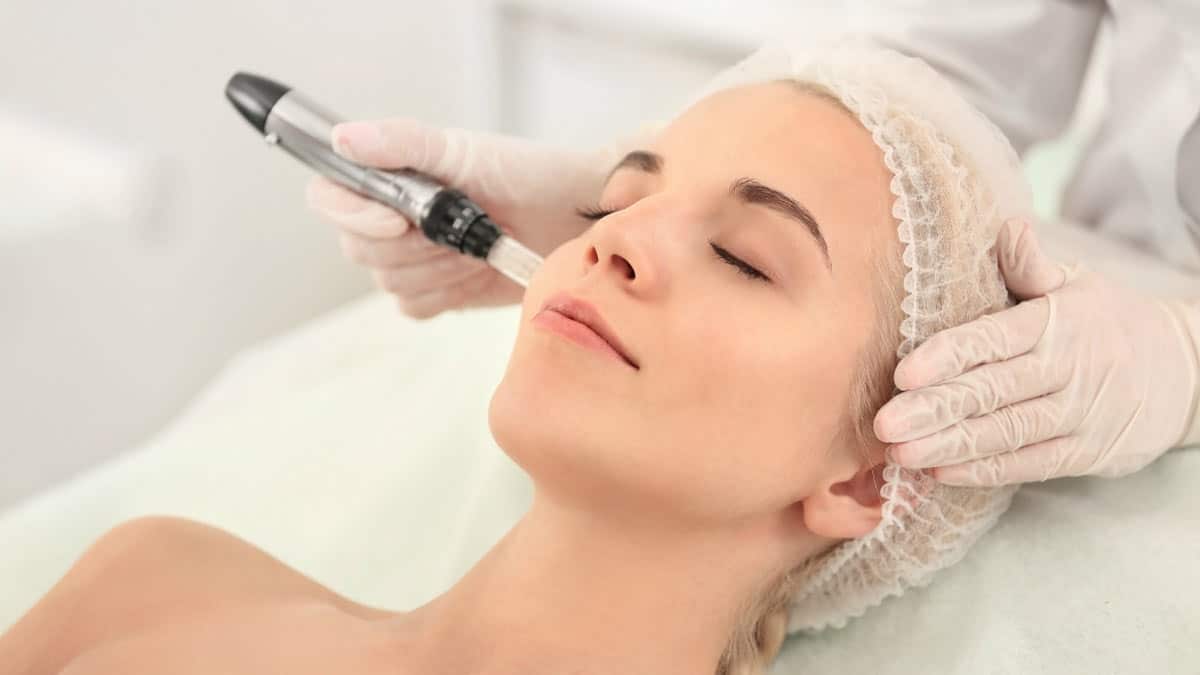 Dermapen (Microneedling)